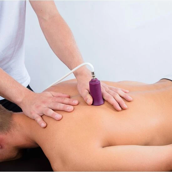 BellaBambi Schröpfsauger-Set "Multi" 4 BellaBambi Schröpfsauger-Set "Multi" – Bild 2